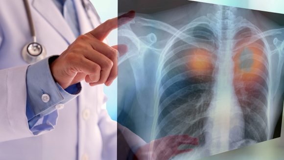 En este momento estás viendo Diseñan modelo de inteligencia artificial capaz de identificar con precisión el cáncer