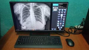 Lee más sobre el artículo Especialistas avileños de electromedicina recuperan equipo de Rayos X Digital