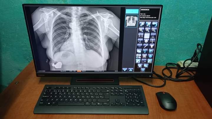 En este momento estás viendo Specialists in electromedicine from Ciego de Avila  recover Digital X-Ray equipment