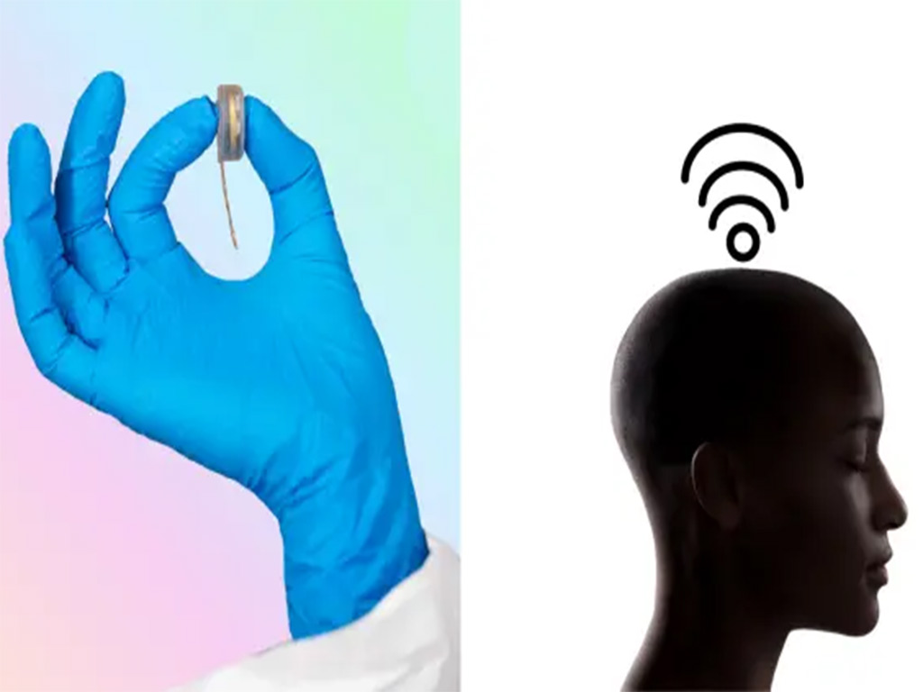 En este momento estás viendo Telepathy, ¿el chip del futuro?