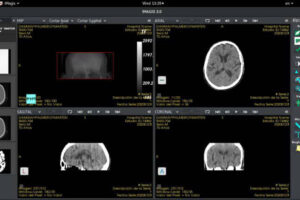 Lee más sobre el artículo Plataforma Imagis moderniza servicios de Radiología