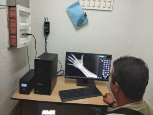 Lee más sobre el artículo Rescatan en Chambas el servicio digital de rayos X