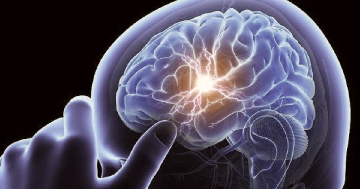 Lee más sobre el artículo Desarrollan en Morón un Taller sobre enfermedades cerebro vasculares