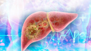 Autoridades sanitarias investigan posible brote de hepatitis en Ciego de Ávila