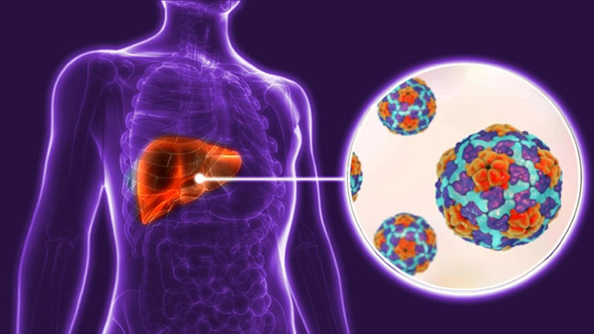 Lee más sobre el artículo Evolución favorable de casos de hepatitis en Ciego de Ávila
